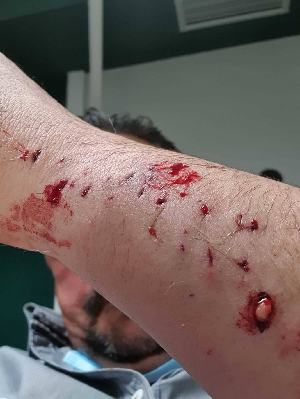 Dos pitbull atacan a un hombre en Villaobispo