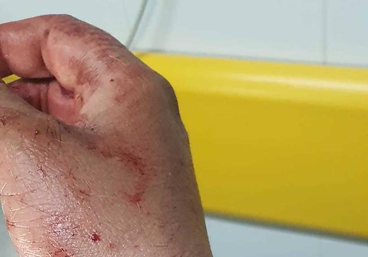 Dos pitbull atacan a un hombre en Villaobispo