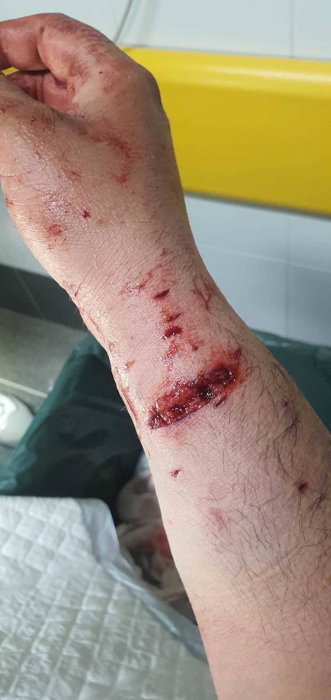 Dos pitbull atacan a un hombre en Villaobispo