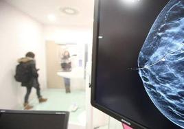 Sacyl ampliará a los 74 años las mamografías para detectar cáncer de mama