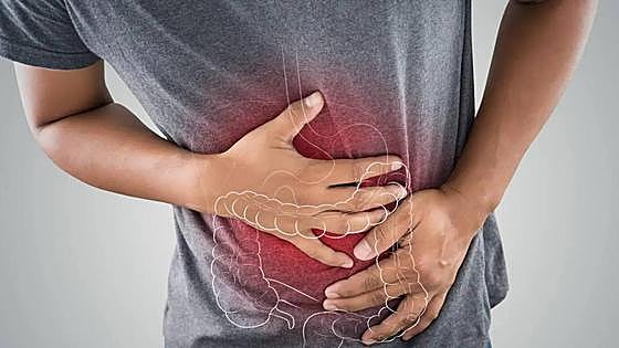 Sanidad amplía el cribado de cáncer colorrectal hasta los 74 años