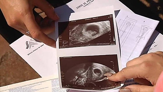 ¿Hasta qué semana se puede abortar en España?