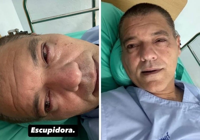 El leonés Frank Cuesta, hospitalizado de urgencia tras la mordedura de una cobra escupidora