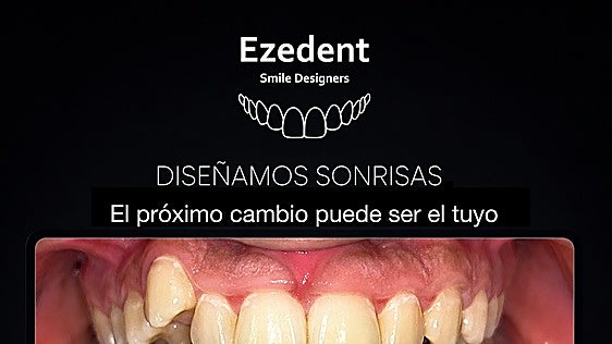 ¿Sueñas con una sonrisa alineada, sana y segura?