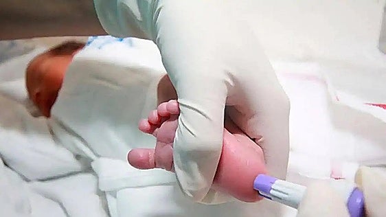 Castilla y León ampliará en enero la prueba del talón hasta detectar 29 enfermedades endocrino-metabólicas