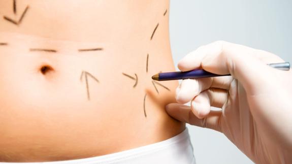 ¿Cuánto tiempo después del parto puede realizarse una abdominoplastia?