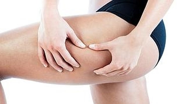 Fotos: 10 anticelulíticos para acabar con la piel de naranja