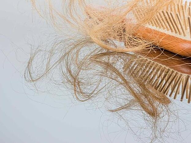Caida de pelo