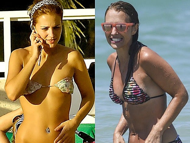 Paula Echevarría antes y después de pasar por el quirófano