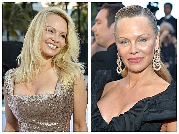 Pamela Anderspn hace dos semanas y ahora. ¿El cambio se debe a su peinado?