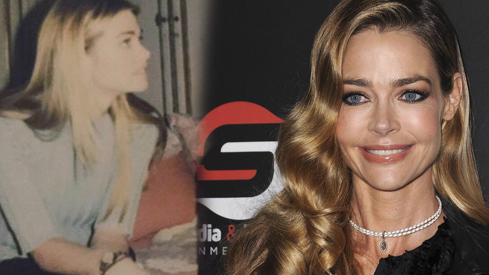 La actriz Denise Richards ha pasado por quirófano varias veces: aumento de pecho, inyección de bótox, aumento de pómulos y de labios... y se nota.