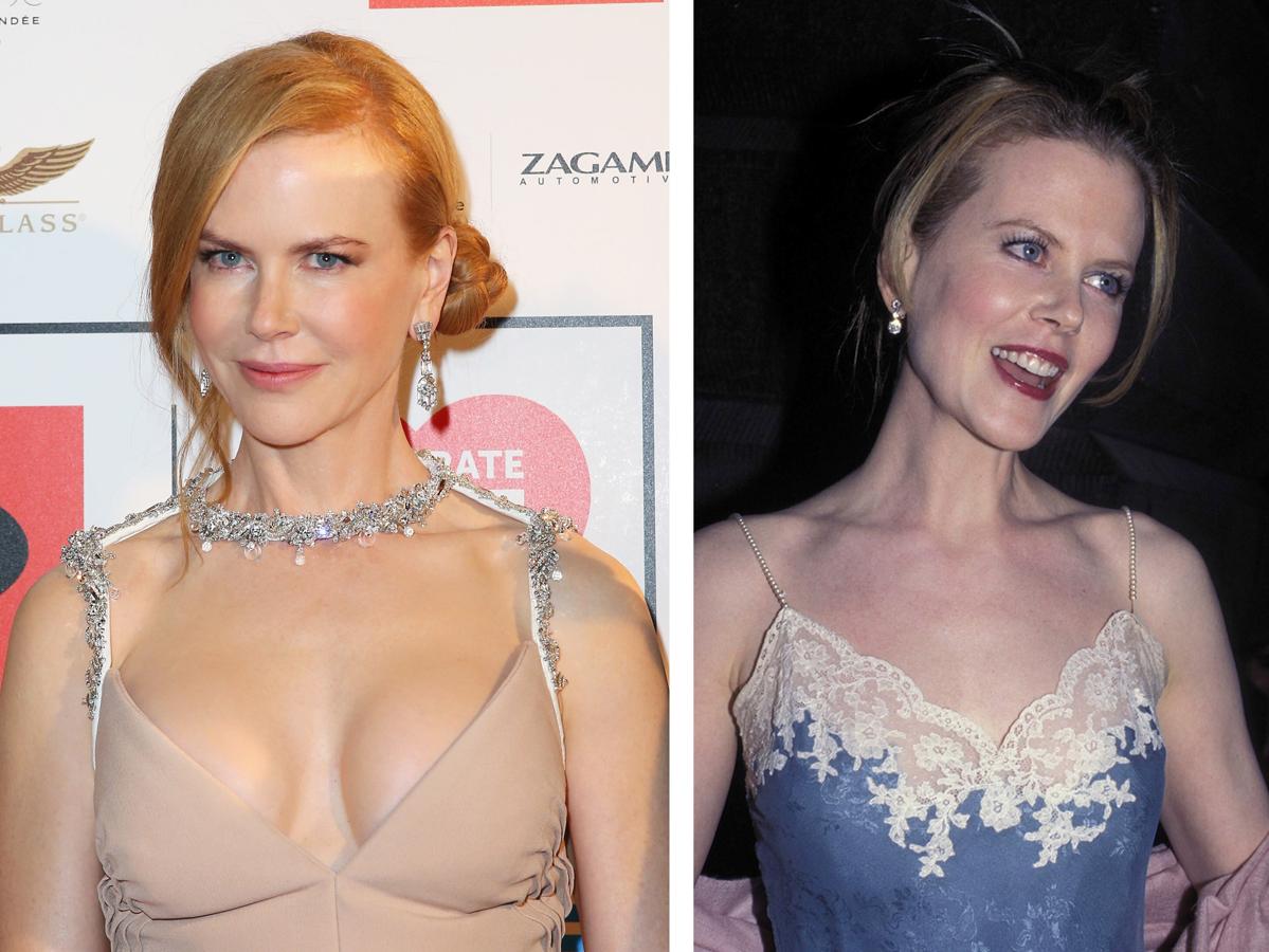 La actriz australiana es otra de las famosas que se ha operado el pecho, además de hacerse algún arreglito más.