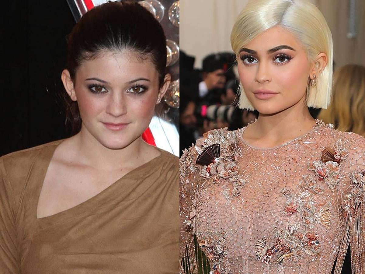 Uno de los dos cambios más asombrosos que hemos visto en la familia es el experimentado por la pequeña. Con o sin ayuda Kylie luce irreconocible pero parece compartir el talento para los negocios del resto y se ha convertido en la dueña de un imperio beauty.