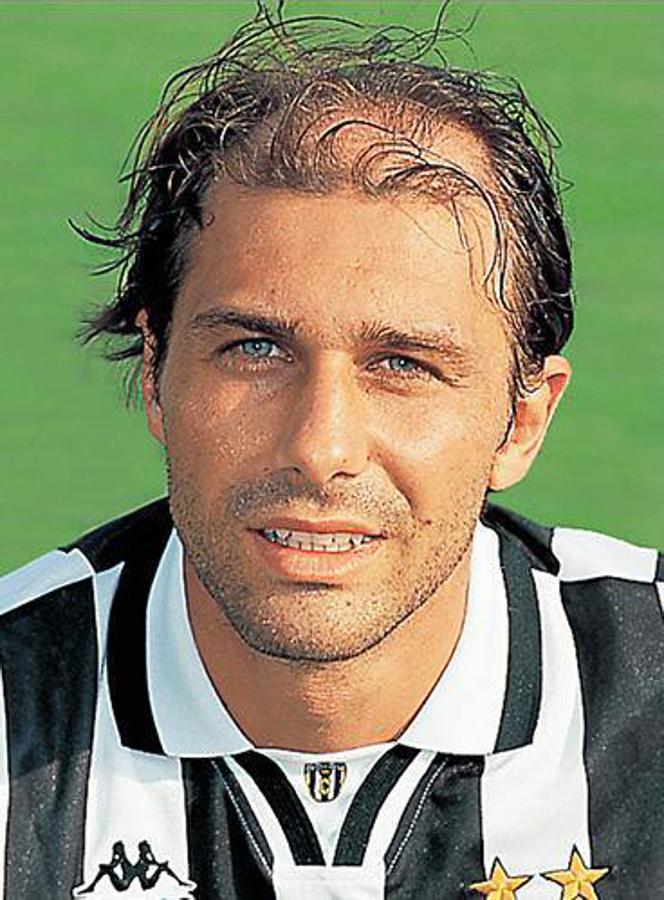 Antonio Conte, como Benjamin Button, tiene la particularidad de rejuvenecer con los años. En 1996 ya estaba así de calvo con su equipo, la Juventus de Turín.