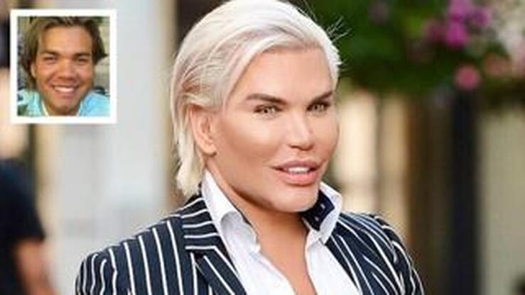 Fotos: El Ken humano se opera de nuevo (y otros adictos al bisturí)