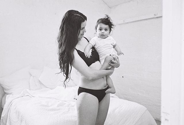 También de sus cicatrices. ¿Por qué avergonzarse de ellas?