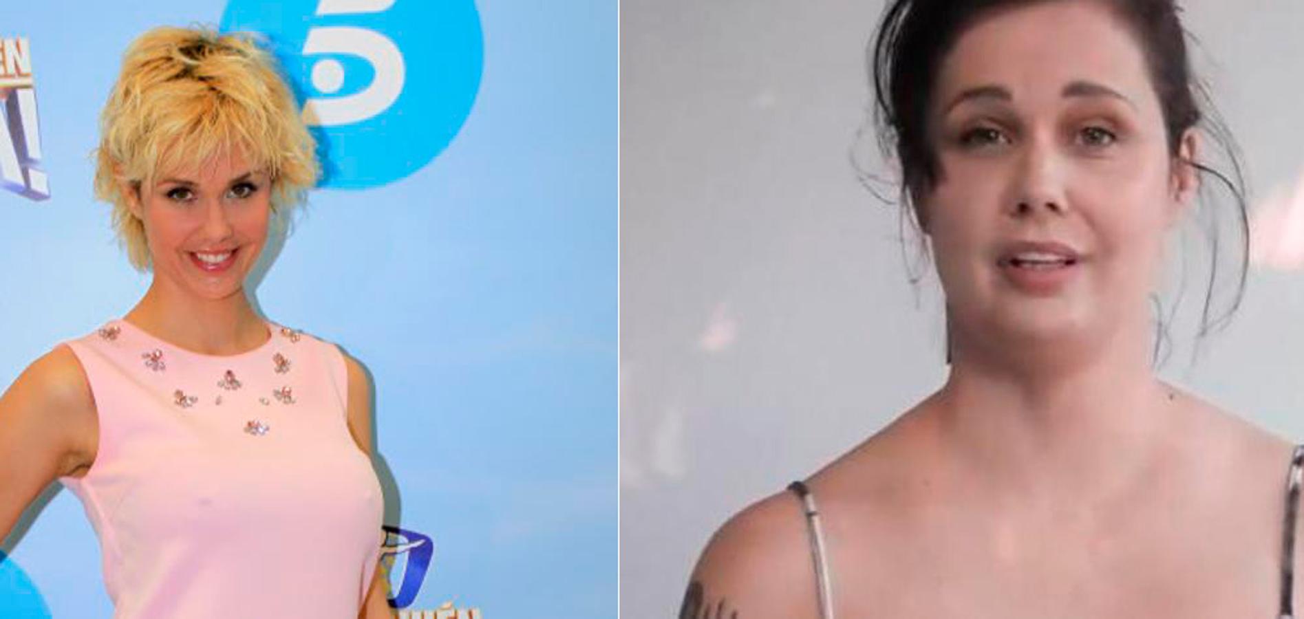 Miriam Sánchez, ex de Pipi Estrada, ha sido la última en sorprendernos con un aumento de peso más que notable. Se ha sometido a una operación para volver a su figura.