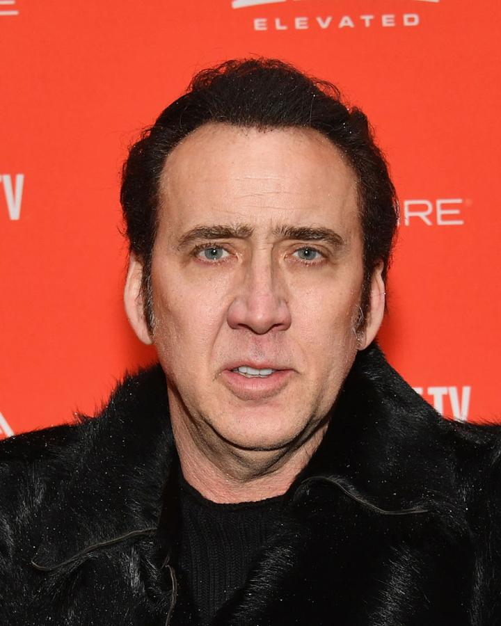 Nicholas Cage optó por los microinjertos y el resultado final le ayudó a quitarse algunos años de encima.