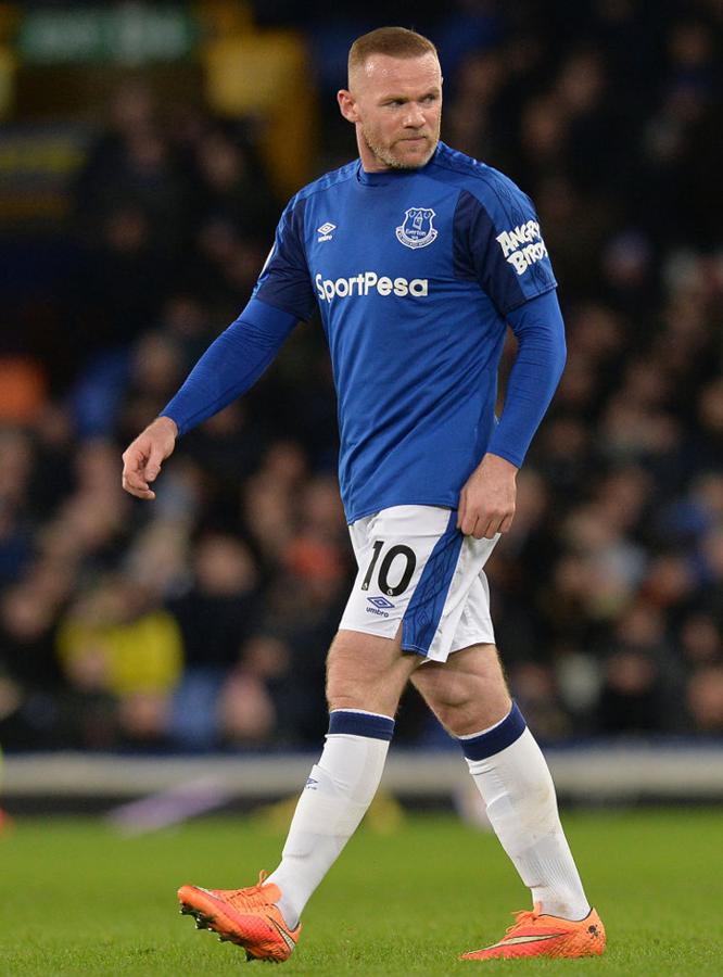 Entre los futbolistas es muy habitual practicarse un injerto de pelo. Rooney es uno de ellos.