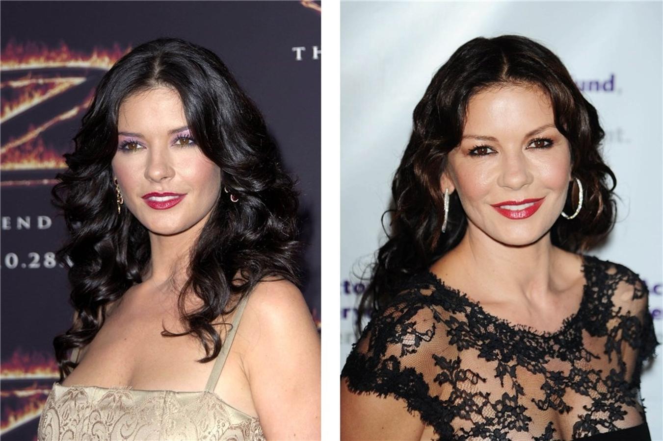 Fotos: El antes y el después de los famosos que se han retocado la cara