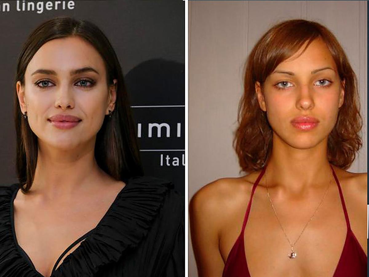 La modelo también se ha dejado seducir por el bisturí.