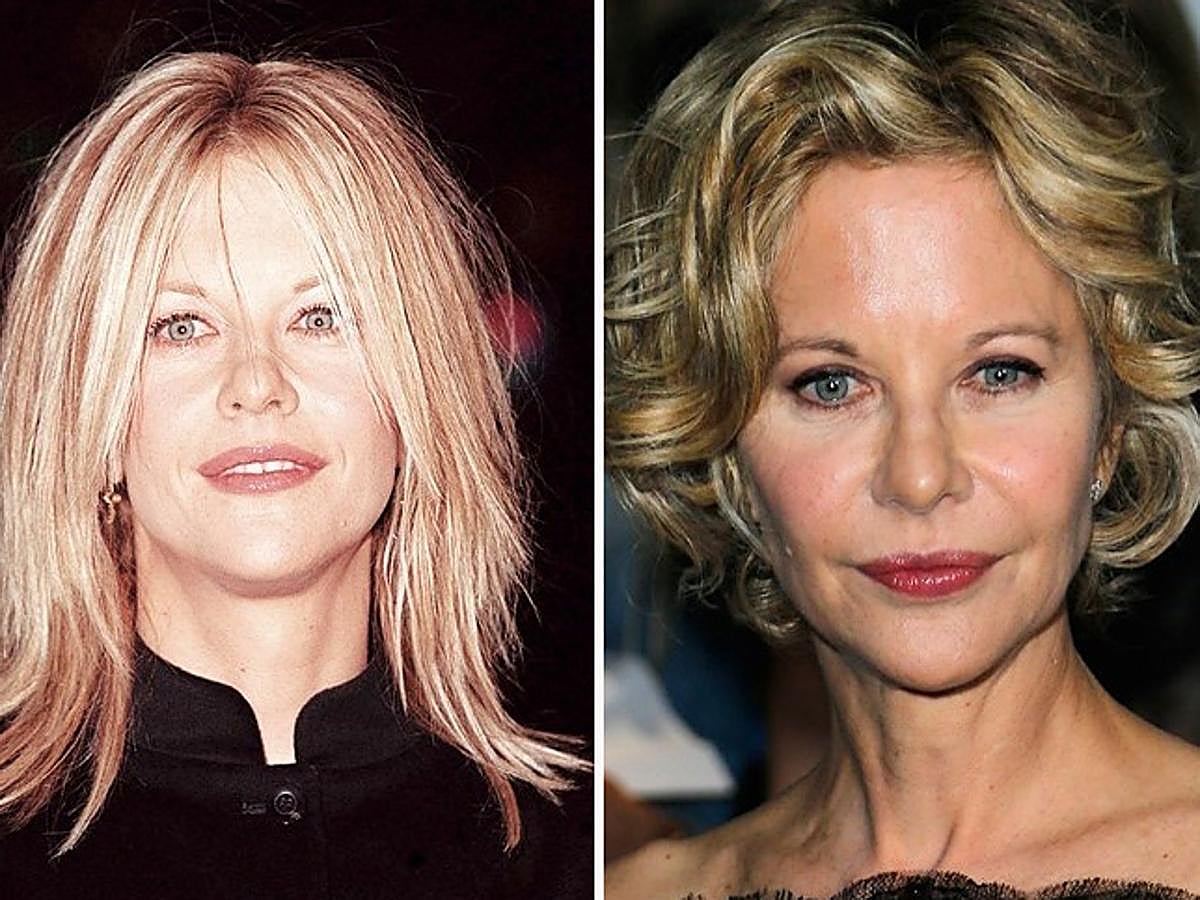 Meg Ryan ha sido una de las actrices de Hollywood que más operaciones se ha hecho en el rostro.