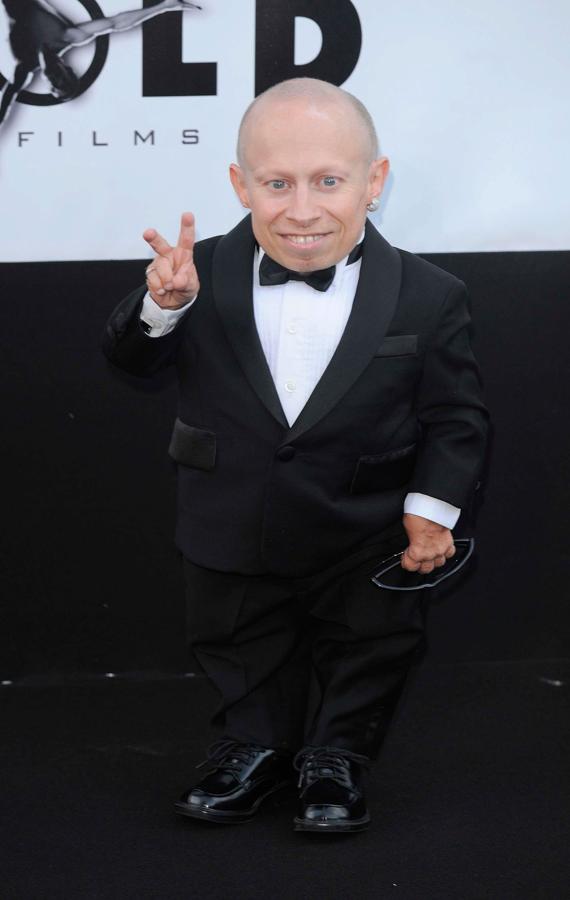Verne Troyer, actor conocido por su papel de Mini Yo en la saga 'Austin Powers', falleció a los 49 años el 21 de abril de 2018.