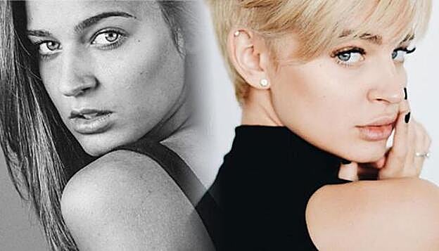 Laura Escanes, el antes y el después de su retoque estético.