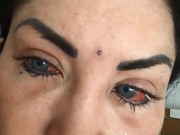 Una imagen de la modelo tras la operación.