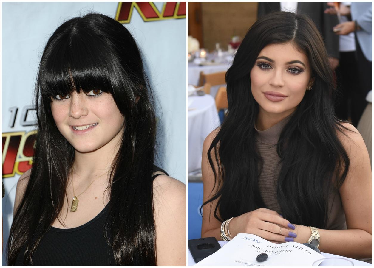 Kylie Jenner tiene 20 años y es la más pequeña del mediático y todo poderoso clan Kardashian. La revista Time la ha ubicado entre los jóvenes más influyentes y no es para menos más de 108 millones de usuarios siguen paso a paso cada uno de sus movimientos en Instagram. A lo largo de su vida, la mayor parte de ella ha quedado inmortalizada en el programa ‘Las Kardashian’, la también empresaria ha cambiado su estilo y aspecto físico.
