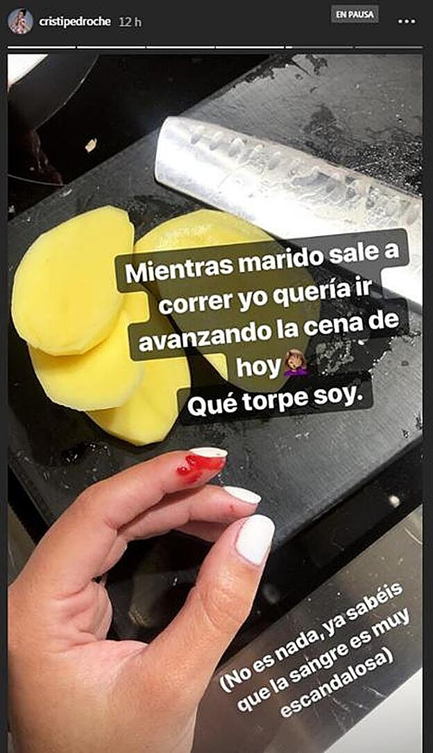 Esta es la imagen que ha compartido Cristina Pedroche con el corte en su dedo.