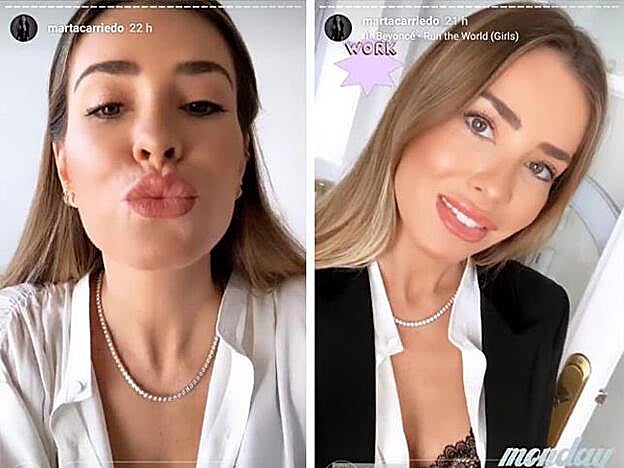 El resultado es de unos labios mucho más carnosos y con más volumen.
