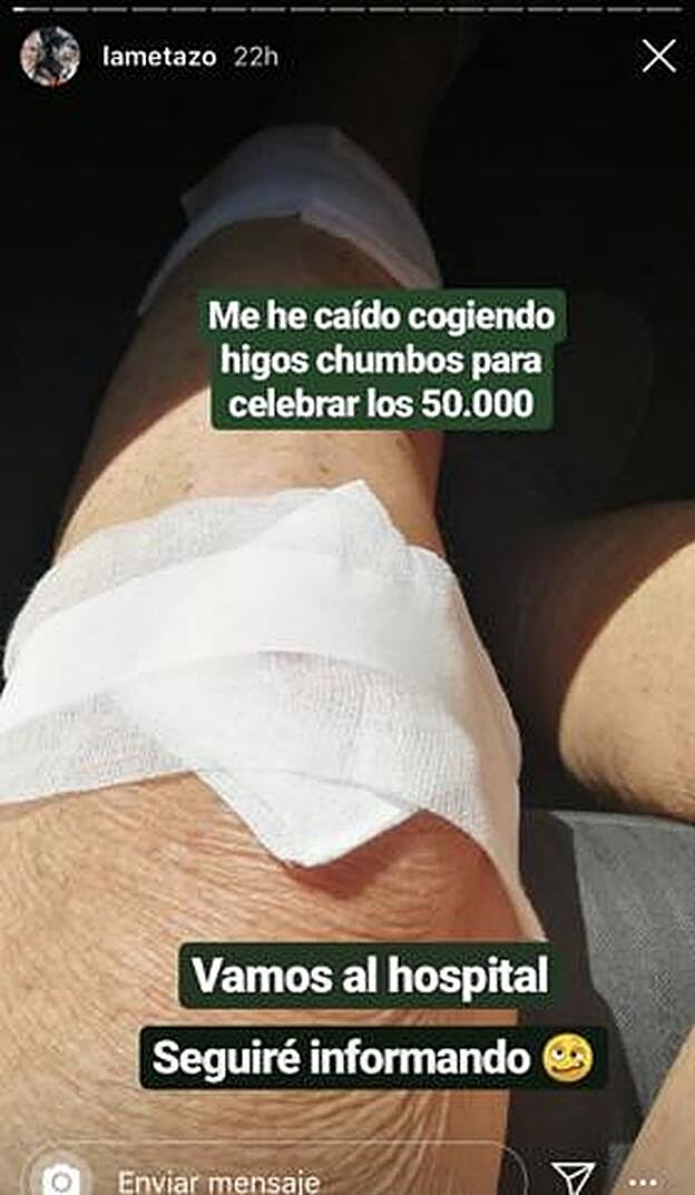 Mercedes Mila y su accidente.