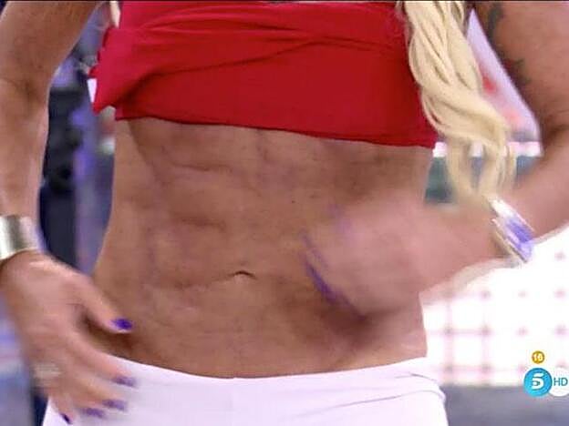 Así han quedado los abdominales de Leticia Sabater tras la operación que se realizó antes de verano.