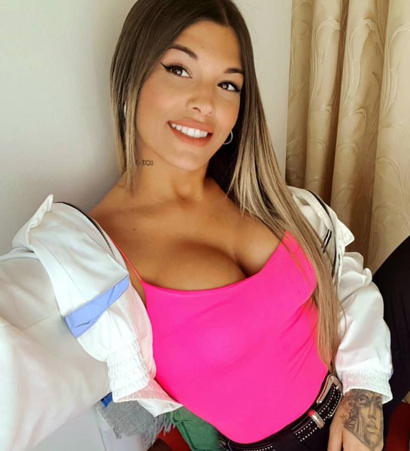 Es evidente que la también concursante de Mujeres Hombres y Viceversa se ha sometido a una cirugía de mamas, con un considerable aumento de las mismas. También podemos hablar del uso del bótox en el rostro, ya que no se le aprecia ninguna línea de expresión en la frente. No podemos decir nada más porque desconocemos quién es y no sabemos cómo era antes.