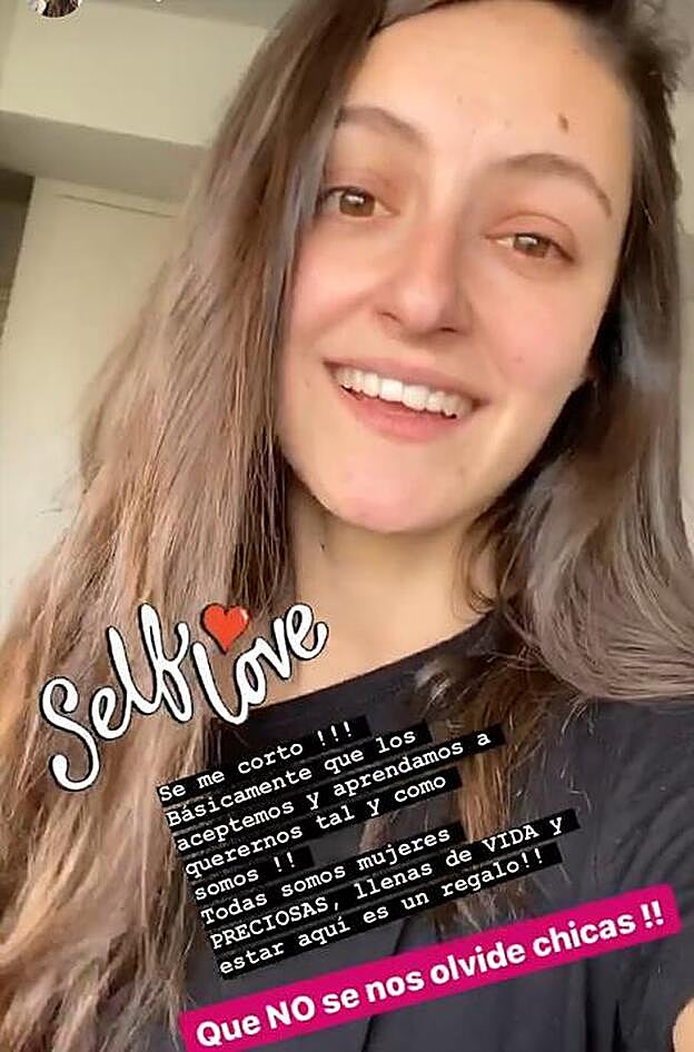 La actrizha ha animado, a través de sus stories, a aceptar y a querer nuestro rostro tal como es.