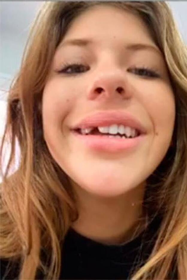 Así estaba Anita Matamoros hace un par de días, tras darse el golpe en casa que le ha obligado a pasar por el quirófano.