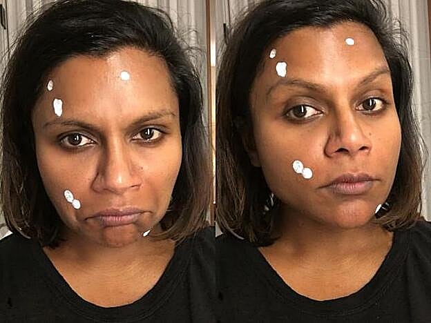 La actriz Mindy Kaling sufre brotes de acné.