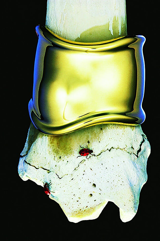 Modelo de su ya clásico Bone para Tiffany & Co., que creó por su fascinación por los huesos desde niña.