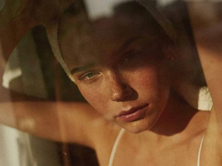 Fotos: 8 productos con niacinamida para eliminar las manchas que salen con el sol