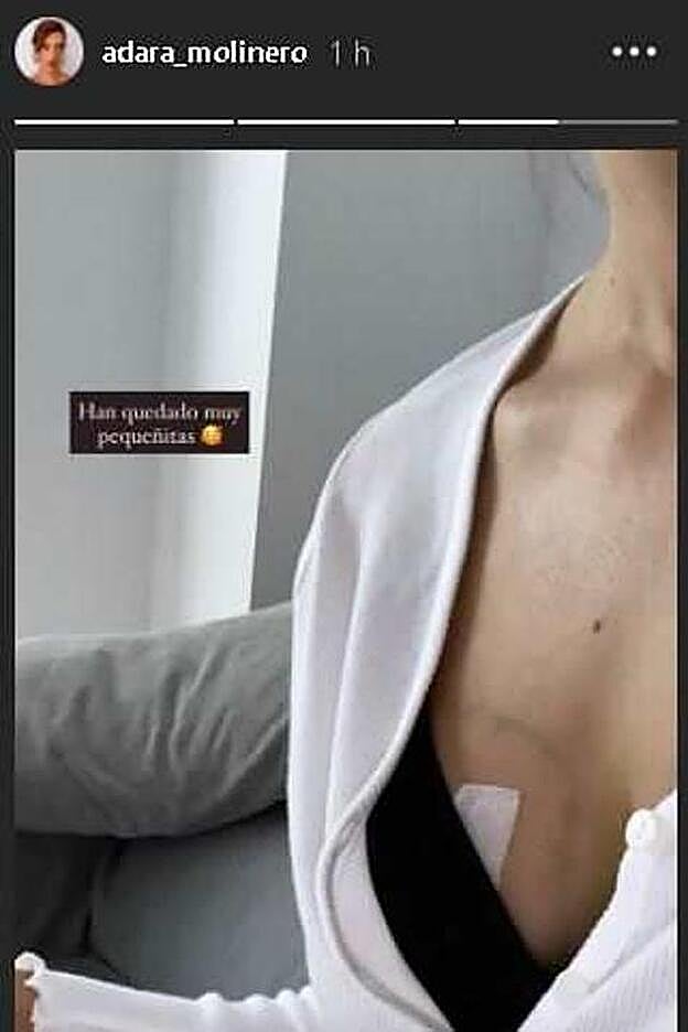 Este es el resultado del pecho de Adara.