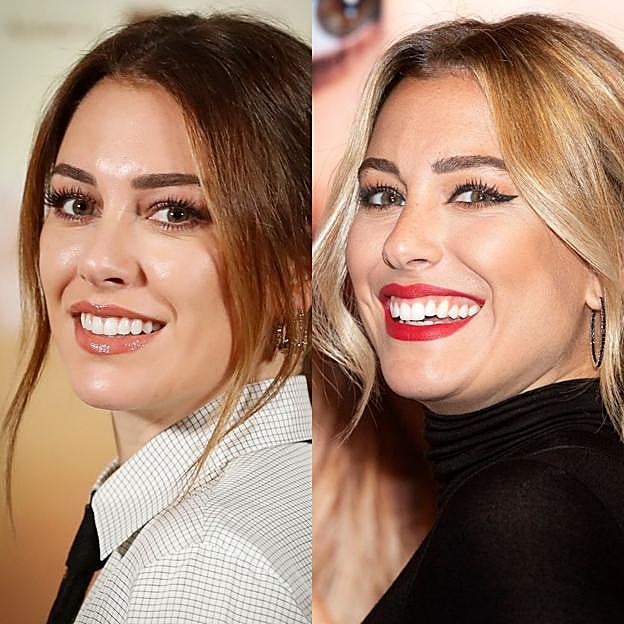 El antes y el después de la sonrisa de Blanca Suárez.