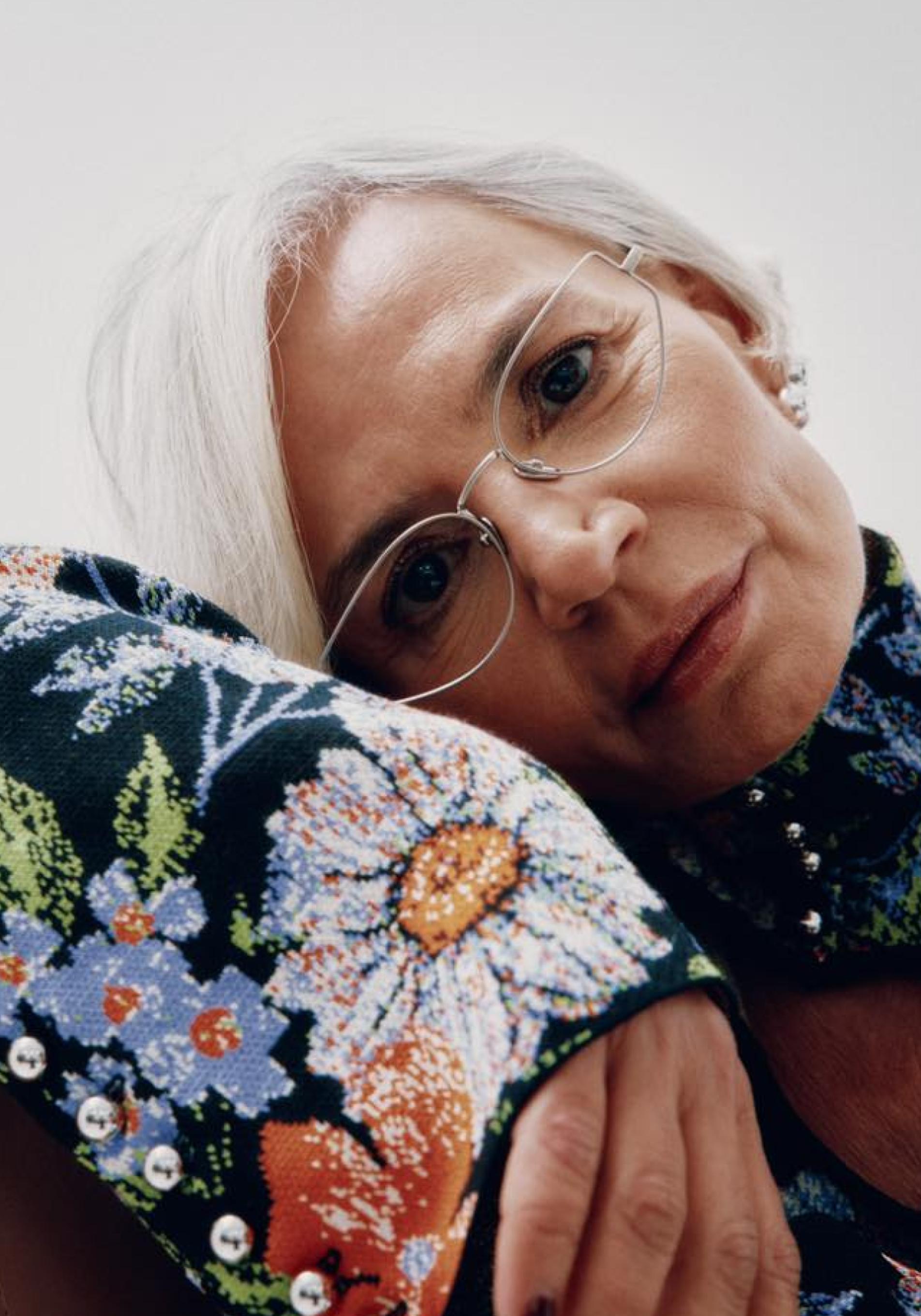 Estos son los mejores parches de colágeno para combatir arrugas. 