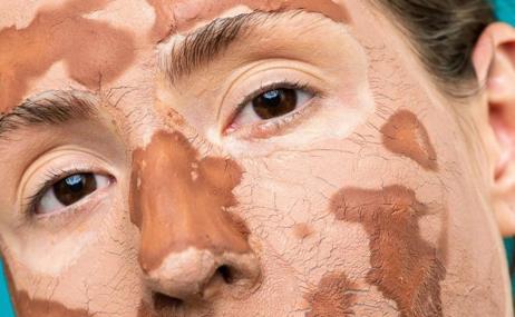 La peligrosa moda de untarse la cara con grasa de vaca: así es el ‘beef tallow’ para tratar la piel seca