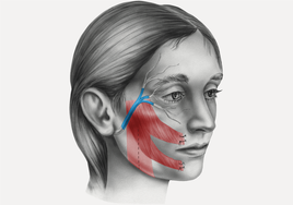 Resfriados que terminan en parálisis facial