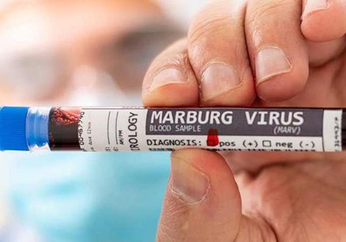 Virus de Marburgo, una amenaza cercana, real y mortal