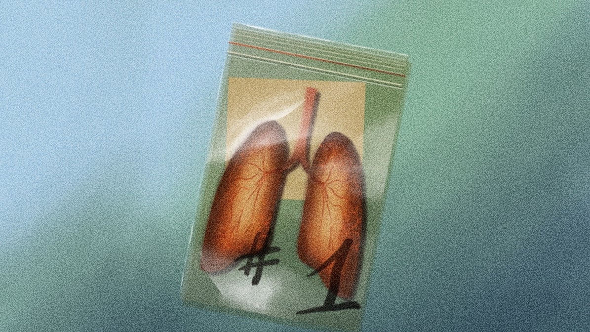 Pulmones de hielo