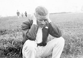 Joyce con un parche ocular tras su primera operación por glaucoma.