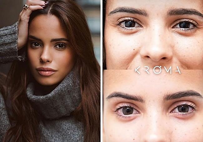 Gloria Camila Ortega después de someterse a la operación.