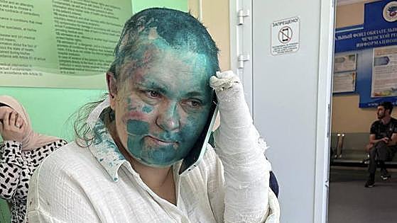 Brutal agresión en Chechenia a una periodista de investigación rusa